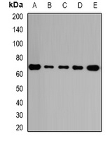 GalNAc-T2 Rabbit Polyclonal Antibody