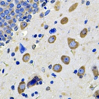 Anti-GalNAc-T2 Antibody
