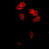 Anti-GalNAc-T2 Antibody