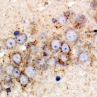 Anti-GPI Antibody