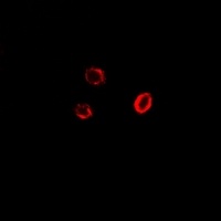 Anti-GPI Antibody
