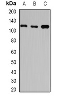 HIP1 Rabbit Polyclonal Antibody