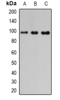 PDE6-beta Rabbit Polyclonal Antibody