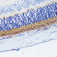 PDE6-beta Rabbit Polyclonal Antibody