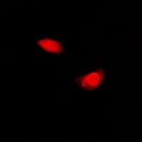 Anti-Periplakin Antibody