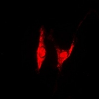 Anti-PSMD8 Antibody