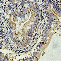 Anti-GlnRS Antibody