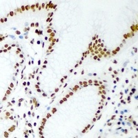 RBBP7 antibody