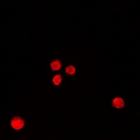 Anti-RbAp46 Antibody