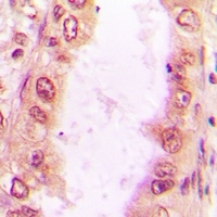 Anti-Sm-D2 Antibody