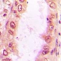 SNRPD2 antibody