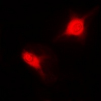 SNRPD2 antibody