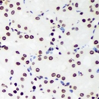 Anti-Sox-5 Antibody