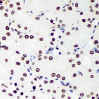 SOX5 antibody