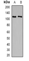 TRPC4 Rabbit Polyclonal Antibody