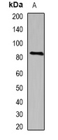 SEMA3B Antibody