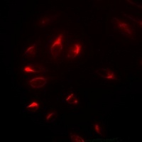 Anti-NELF-E Antibody