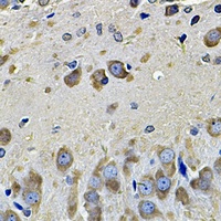 Anti-eIF3C Antibody