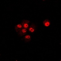 Anti-CIP4 Antibody