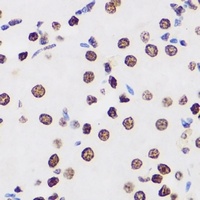 Anti-MacroH2A1 Antibody