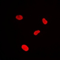 Anti-MacroH2A1 Antibody