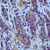 Anti-ERp5 Antibody