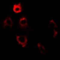 Anti-ERp5 Antibody