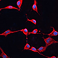 Anti-DNAJA2 Antibody