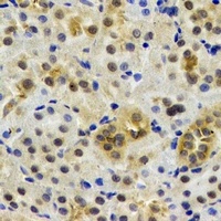 Anti-Rent2 Antibody