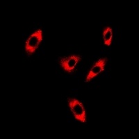 C16orf80 antibody