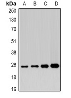 APIP Rabbit Polyclonal Antibody