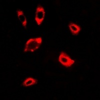 Anti-DPP8 Antibody
