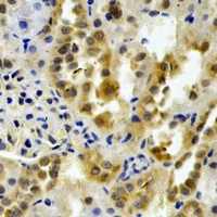 Anti-PTGES2 Antibody