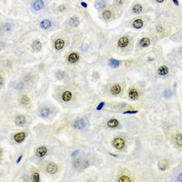 Anti-FIP1L1 Antibody