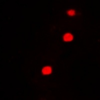 Anti-FIP1L1 Antibody