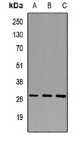 BTEB1 Rabbit Polyclonal Antibody