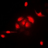 Anti-HEMK2 Antibody