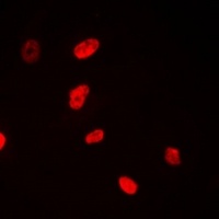 Anti-NSUN6 Antibody