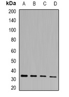 PHYHD1 Rabbit Polyclonal Antibody