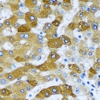 Anti-ACADS Antibody