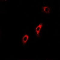 Anti-ACADS Antibody
