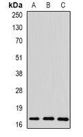 Spot 14 Rabbit Polyclonal Antibody