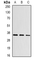 Aspartoacylase Rabbit Polyclonal Antibody