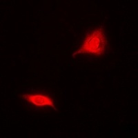 Aspartoacylase Rabbit Polyclonal Antibody