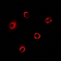Anti-BRCC2 Antibody