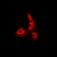 Dermcidin antibody