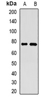 GP73 Antibody