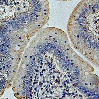 GP73 Antibody