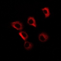 GP73 Antibody