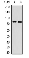 L3MBTL3 Rabbit Polyclonal Antibody